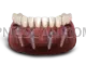 Dental Implant 800x600 cutout from Dental Implant