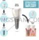 Dental Implant natural cutout from Dental Implant