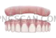 Dental Implant #274 cutout from Dental Implant