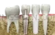 Dental Implant #289 cutout from Dental Implant