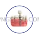 Dental Implant #286 cutout from Dental Implant