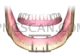 Dental Implant #301 cutout from Dental Implant