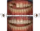 Dental Implant #307 cutout from Dental Implant