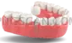 Dental Implant #324 cutout from Dental Implant