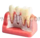 Dental Implant #327 cutout from Dental Implant