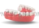 Dental Implant #333 cutout from Dental Implant
