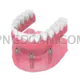 Dental Implant #352 cutout from Dental Implant