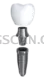 Dental Implant #355 cutout from Dental Implant