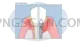 Dental Implant #360 cutout from Dental Implant