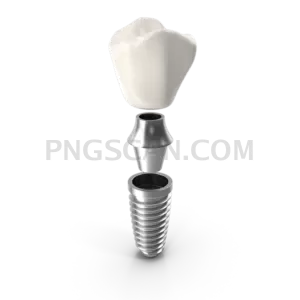 Dental Implant cutout image