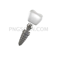 Dental Implant #342 cutout from Dental Implant