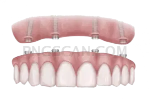 Dental Implant #274 cutout from Dental Implant