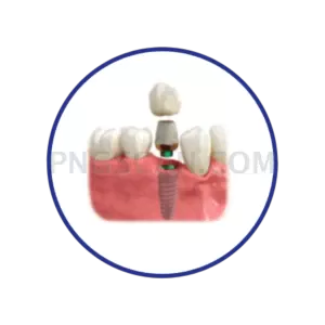 Dental Implant #286 cutout from Dental Implant