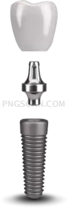Dental Implant #293 cutout from Dental Implant