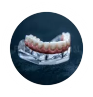 Dental Implant #315 cutout from Dental Implant