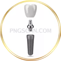 Dental Implant #330 cutout from Dental Implant