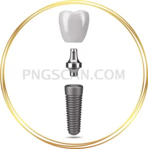 Dental Implant #330 cutout from Dental Implant