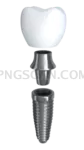 Dental Implant #355 cutout from Dental Implant