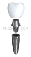 Dental Implant #355 cutout from Dental Implant