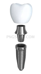 Dental Implant #355 cutout from Dental Implant