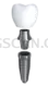 Dental Implant #355 cutout from Dental Implant